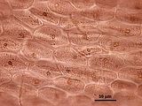 6 - Cellule corticali nella porzione mediana del tallo in visione superficiale